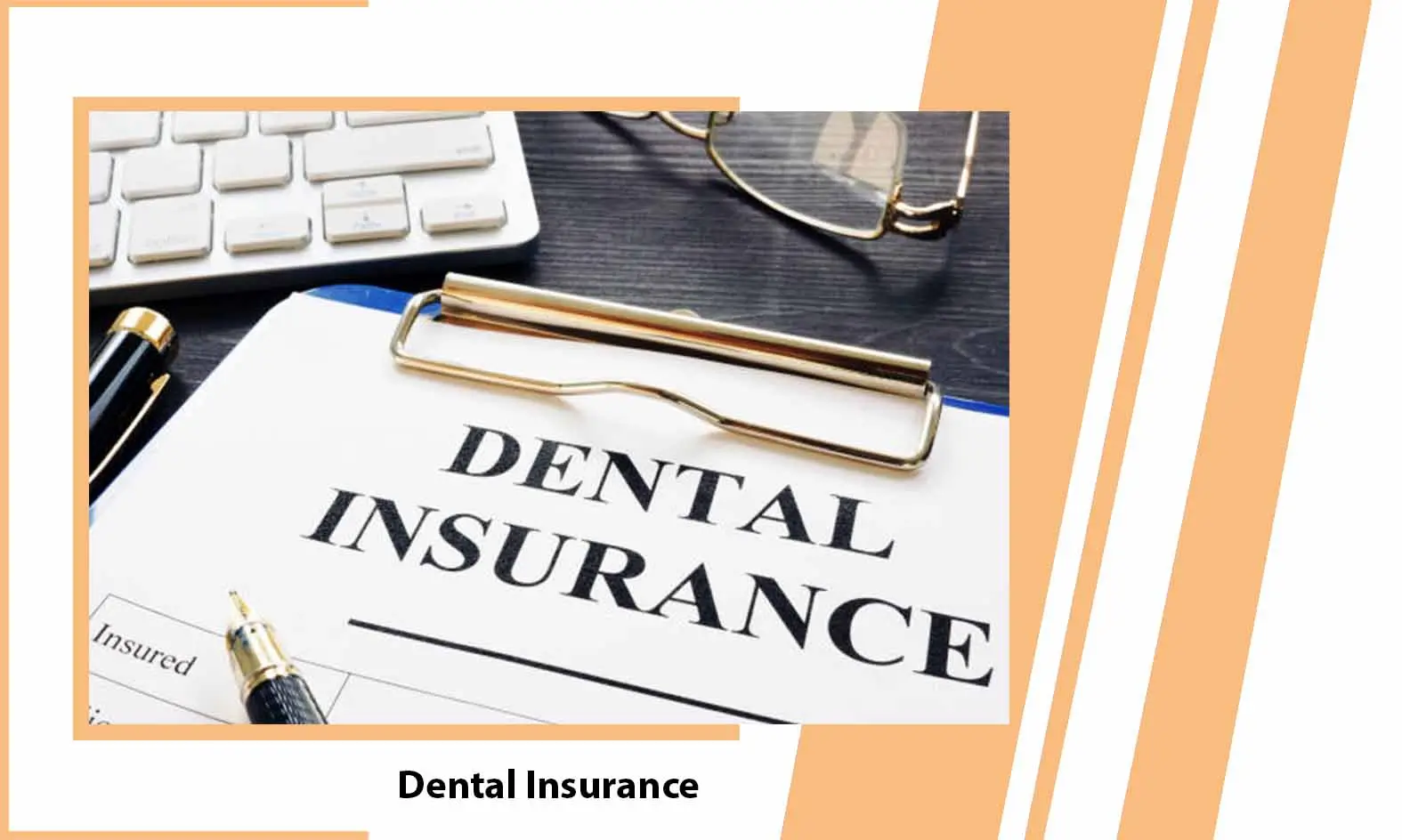 Dental Insurance - What is Dental Insurance