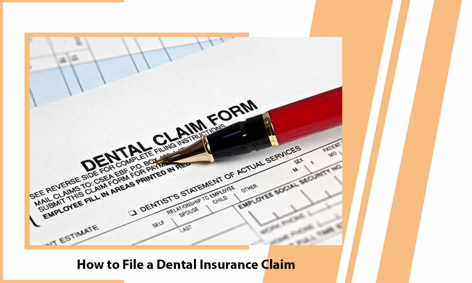 How to File a Dental Insurance Claim