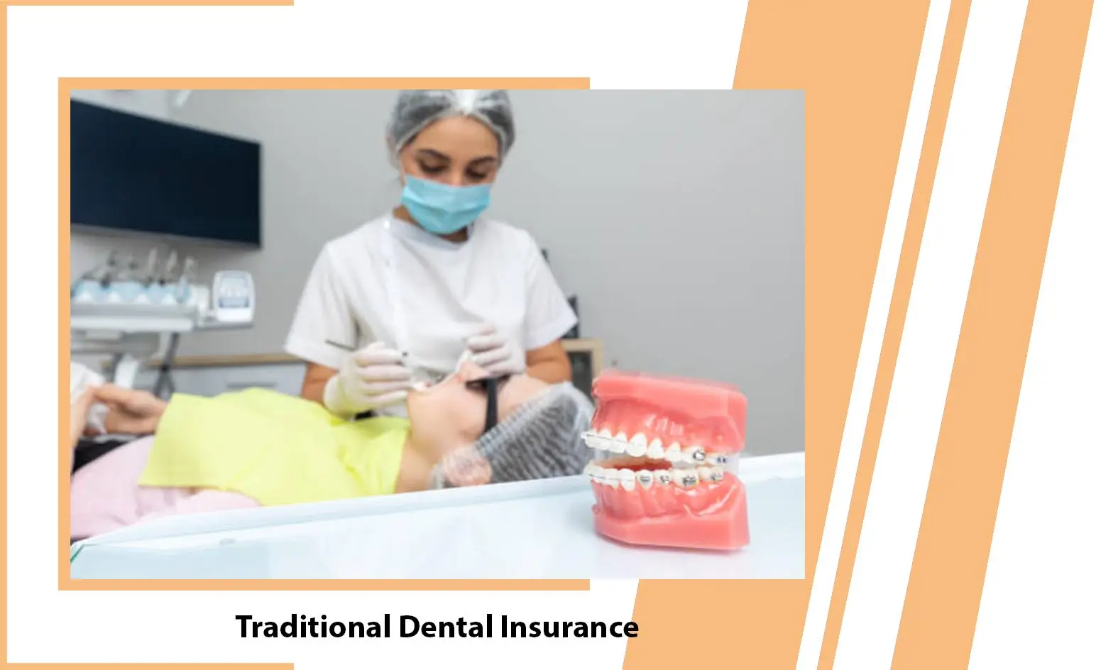 Traditional Dental Insurance - What is Traditional Dental Insurance